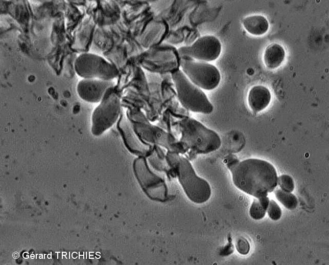 Lindtneria trachyspora (Tulasnella violea)
